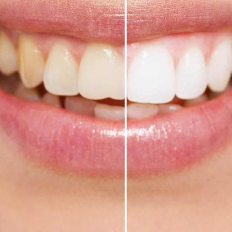 sorriso_2
